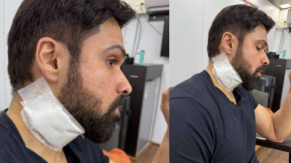 इमरान हाशमी की कटी गर्दन, बहने लगा खून, ‘गुडाचारी 2’ के सेट पर हादसे का हुए शिकार